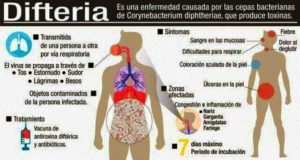 Puerto Plata's population is urged to take preventive measures against a possible outbreak of diphtheria